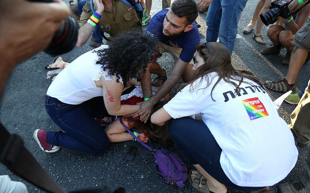 An injured woman after a stabbing in Jerusalem on July 30, 2015. (Eric Cortellessa/Times of Israel)