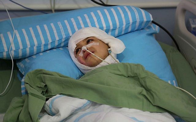 Five-year-old Ahmed Dawabsha lies in his hospital bed at the Chaim Sheba Medical Center at Tel Hashomer, August 24, 2015. (Eric Cortellessa/Times of Israel)