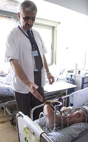 The head of the Ziv Hospital's orthopedic department Dr. Alexander Lerner pointing to Faris's wounded leg. March 10, 2016. (Dov Lieber / Times of Israel)