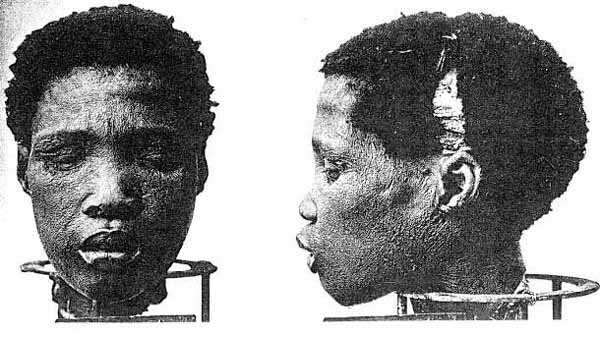 Head of Shark Island prisoner used for medical experimentation (Wikipedia)