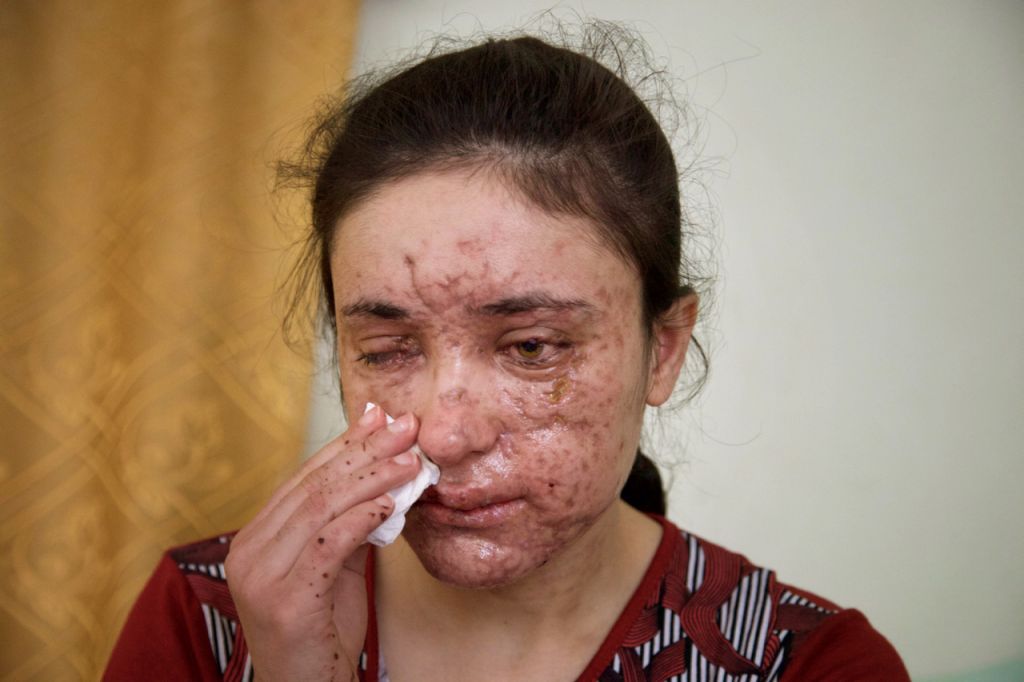 Lamiya Aji Bashar, an 18-year-old Yazidi girl who escaped her Islamic State group enslavers, talks to The Associated Press in northern Iraq in this May 5, 2016 photo (AP Photo/Balint Szlanko)
