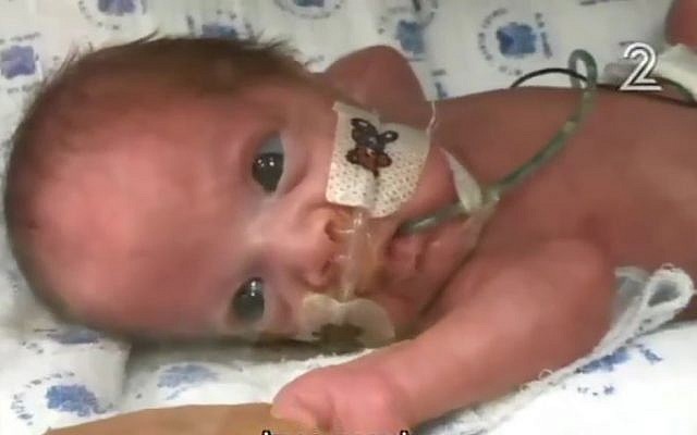 Baby Aharon, in Tel Aviv's Ichilov Hospital (Screen capture: Channel 2)