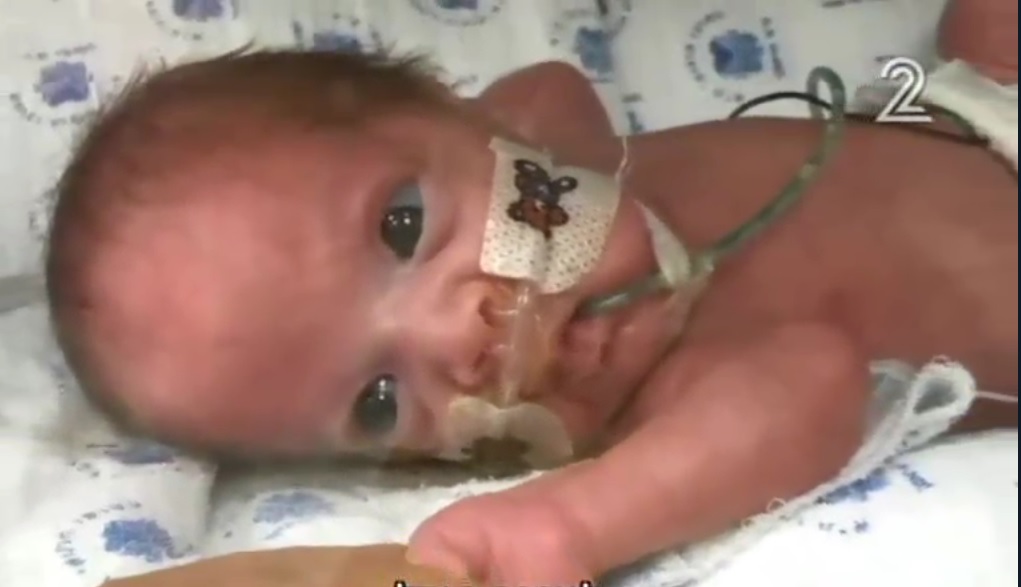 World's smallest' surviving premature baby released from US