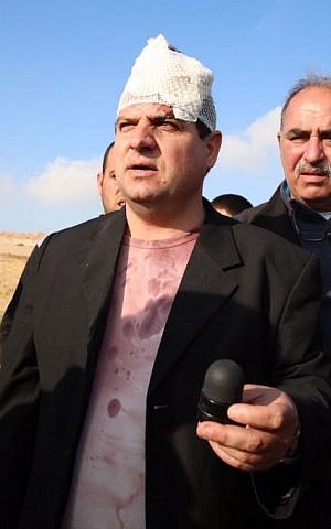 Arab Joint List leader MK Ayman Odeh was injured during a protest against house demolitions in the Negev town of Umm al-Hiran on January 18, 2017. Here he is holding the sponge-tipped bullet that allegedly injured him. (Courtesy/Arab Joint List)
