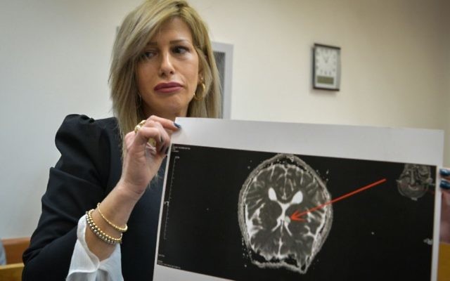 Shira Nir, a lawyer of an American-Israeli teenager suspected of calling in fake bomb threats to Jewish community centers across the world, shows the Rishon Lezion Magistrate's Court what she says is an image of a cancerous growth in her client's brain, on March 30, 2017. (Flash90) 