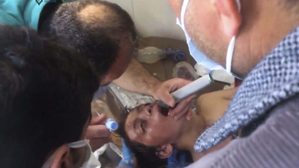 This frame grab from video provided on Tuesday April 4, 2017 shows a Syrian doctor treating a boy following a suspected chemical attack, in the town of Khan Sheikhoun, northern Idlib province, Syria. (Qasioun News Agency, via AP) 