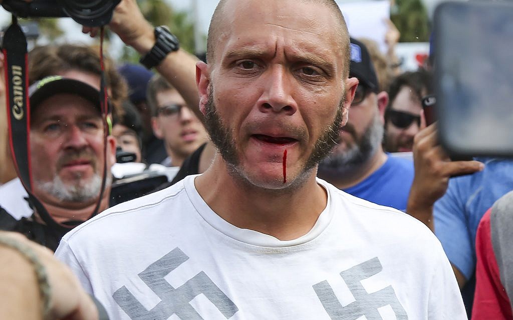 Blood runs from the lip of a man wearing a shirt with swastikas after he was punched by a protester outside a University of Florida auditorium where white nationalist Richard Spencer was preparing to speak, Thursday, October 19, 2017 in Gainesville, Fla. (Will Vragovic/Tampa Bay Times via AP)
