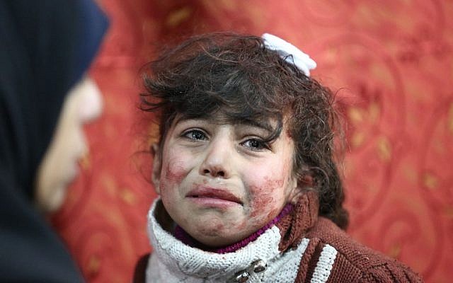 Hala, 9, receives treatment at a makeshift hospital following Syrian government bombardments on rebel-held town of Saqba, in the besieged Eastern Ghouta region on the outskirts of the capital Damascus on February 22, 2018. (AFP PHOTO / AMER ALMOHIBANY)