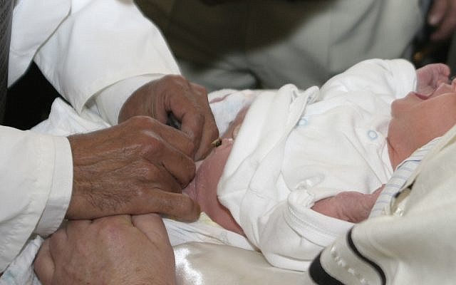 Illustrative image of a circumcision. (yoglimogli, iStock by Getty Images)