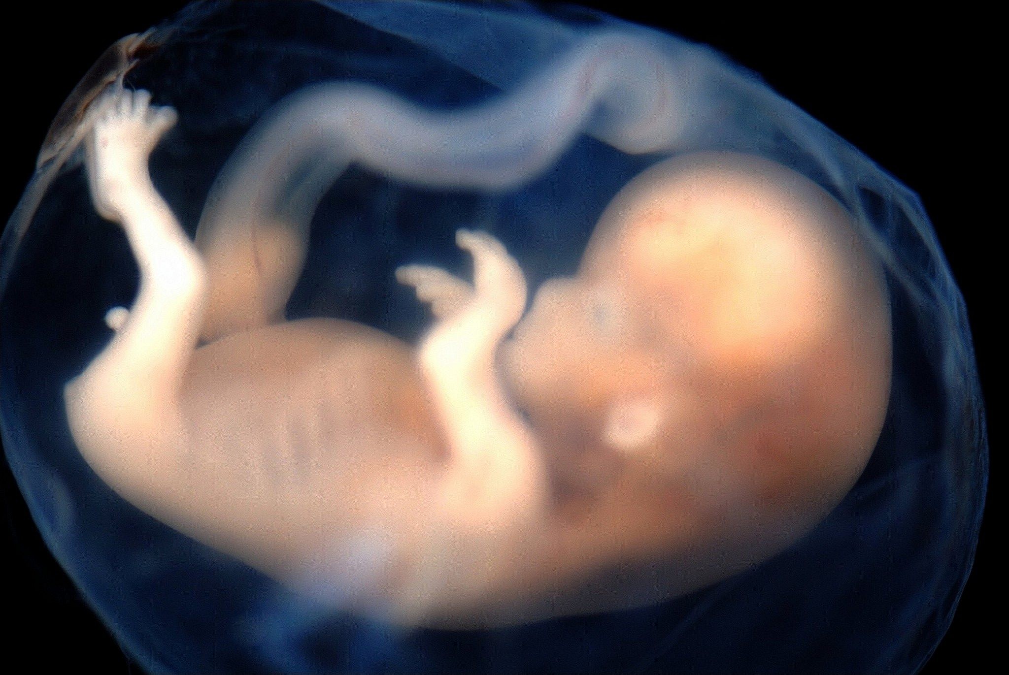 israeli-team-develops-way-to-find-genetic-flaws-in-fetus-at-11-weeks