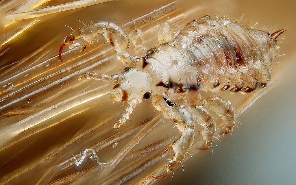 Male human head louse, Pediculus humanus capitis. (Gilles San Martin, CC-BY-SA, via wikipedia)