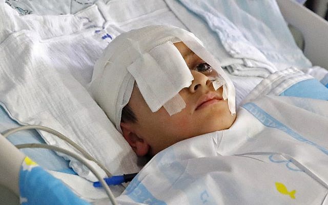 A file photo taken on August 12, 2019 shows Palestinian boy Abdelrahman Shtewi, in a bed in Sheba Hospital in Ramat Gan. (Jack Guez/AFP)