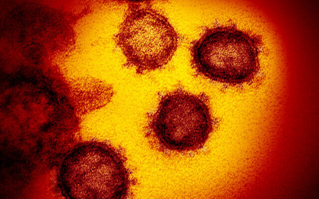 This undated electron microscope image made available by the US National Institutes of Health in February 2020 shows the Novel Coronavirus SARS-CoV-2. Also known as 2019-nCoV, the virus causes COVID-19. (NIAID-RML via AP)