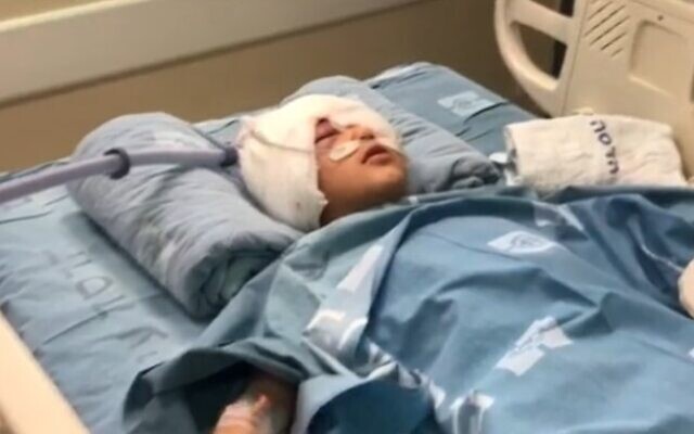 A 9-year-old who was shot in the head by a  a sponge-tipped bullet during a police operation in the East Jerusalem neighborhood of Issawiya in hospital in Jerusalem on February 26, 2020 (Screencapture/Channel 13)
