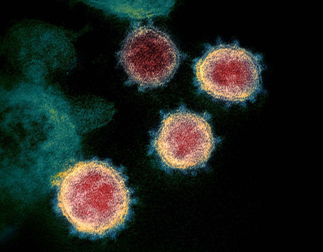Microscopy image showing SARS-CoV-2. The spikes on the outer edge of the virus particles resemble a crown, giving the disease its characteristic name: Coronavirus. (NIAID Rocky Mountain Laboratories / Wikipedia)