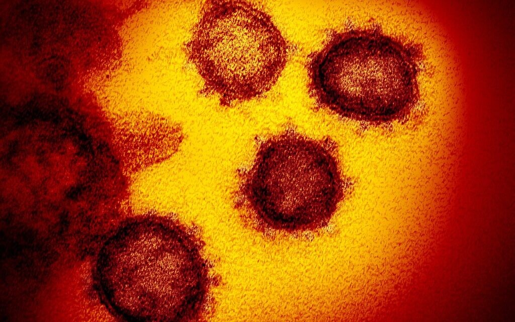 This transmission electron microscope image shows SARS-CoV-2, the virus that causes COVID-19, isolated from a patient in the US, emerging from the surface of cells cultured in the lab. (NIAID-RML / Wikipedia)