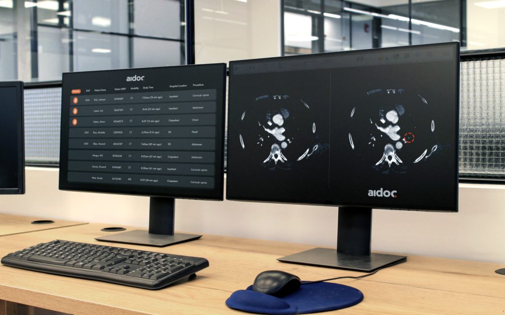 Israel's Aidoc, Radiology Partners join to boost AI use in medical imaging in US - Vimarsana News
