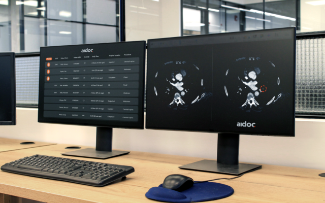 A computer using Aidoc's technology reports findings on a CT scan (courtesy of Aidoc)