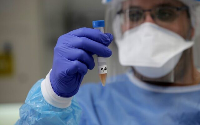 An Israeli medical worker tests samples of suspected Covid-19 cases in Tel Aviv on June 9, 2020. (GIL COHEN-MAGEN / AFP)
