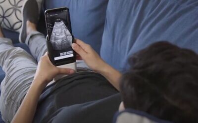 The hand-held ultrasound developed by PulseNmore, allows women to monitor the wellbeing of the fetus at home (YouTube screenshot)