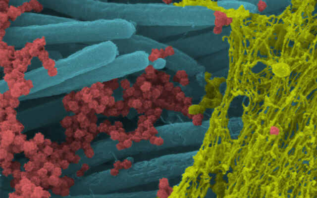 An image produced by US researchers shows SARS-CoV-2 virus particles (red), covering human bronchial cilia (blue), and mucus (yellow). (Ehre Lab, UNC School of Medicine)