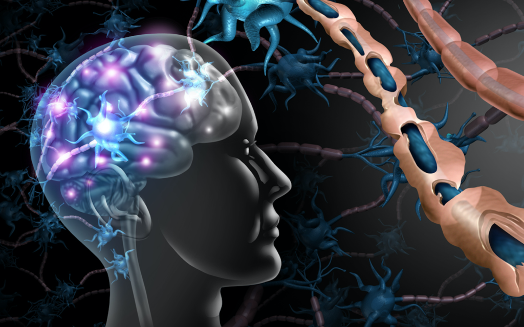 Jerusalem study finds stem cell treatment 'freezes' MS, lets some walk again - Vimarsana News