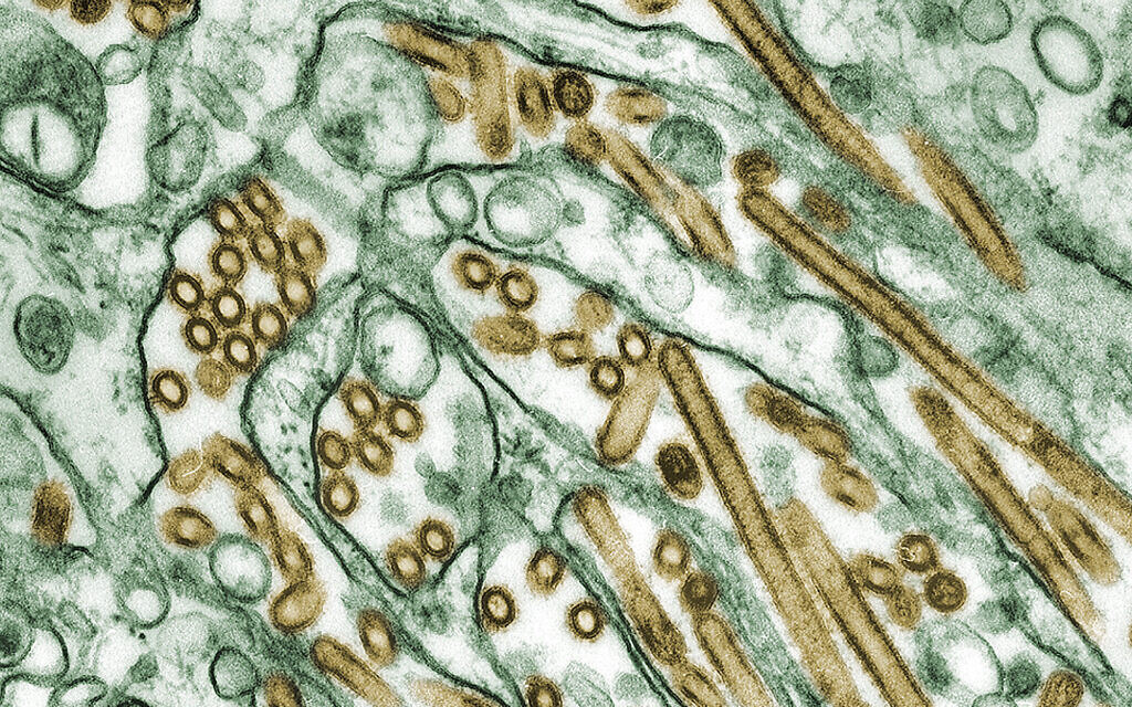 Photo of Rusko registruje prvý prípad vtáčej chrípky H5N8 u ľudí, ktorý varuje WHO