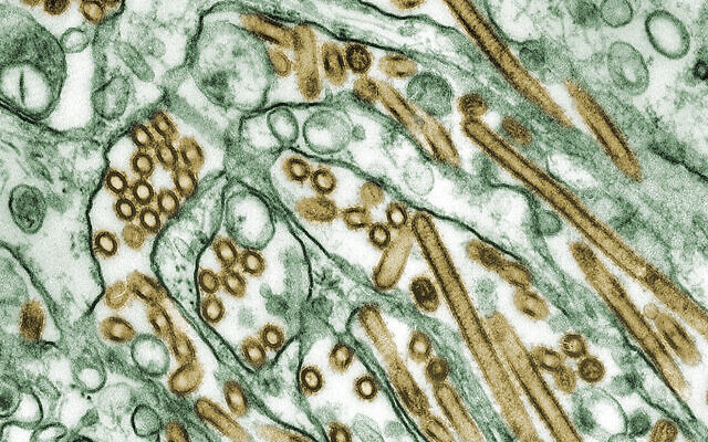 Illustrative: Colorized transmission electron micrograph of Avian influenza A H5N1 viruses (seen in gold) grown in MDCK cells (seen in green). (Cynthia Goldsmith Content Providers: CDC / Wikipedia)