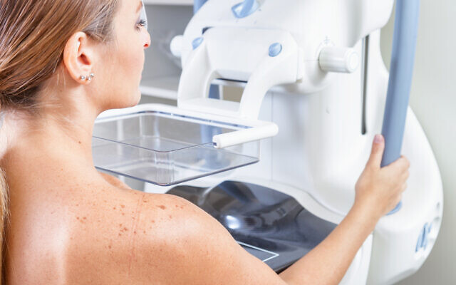 A woman undergoing a medical mammography scan. (jovannig via iStock by Getty Images)