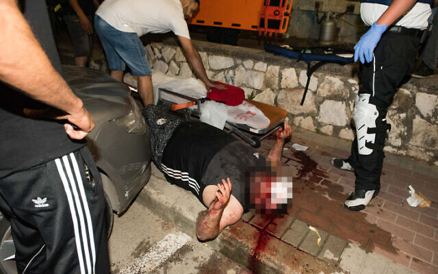 An injured man during clashes between Arab and Jews in Acre, northern Israel, May 12, 2021 (Roni Ofer/Flash90)