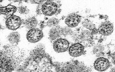 This 2020 electron microscope image made available by the US Centers for Disease Control and Prevention shows the spherical coronavirus particles from what was believed to be the first U.S. case of COVID-19. (C.S. Goldsmith, A. Tamin/CDC via AP)
