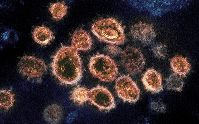 SARS-CoV-2 virus particles, which cause COVID-19, isolated from a patient in the U.S., emerging from the surface of cells cultured in a lab. (NIAID-RML via AP)
