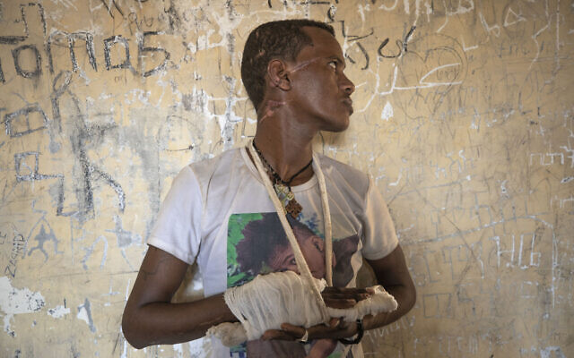 FILE - Ethnic Tigrayan survivor Abrahaley Minasbo, 22, from Mai-Kadra, Ethiopia, shows wounds from machetes he says were inflicted by a pro-government militia on Nov. 9, inside a shelter in Hamdeyat Transition Center near the Sudan-Ethiopia border, in eastern Sudan on Dec. 15, 2020 (AP Photo/Nariman El-Mofty, File)