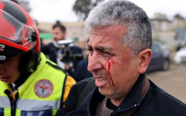 AP photographer Mahmoud Illean reacts after being attacked by Israeli security forces during the coverage of a demonstration in the East Jerusalem neighborhood of Sheikh Jarrah, on December 17, 2021. (AHMAD GHARABLI/AFP)