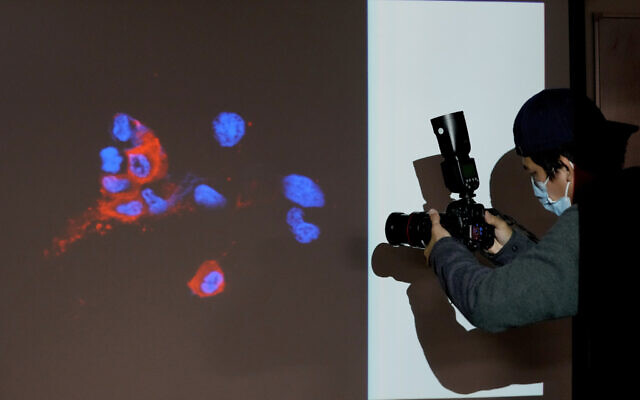 Illustrative image: A photographer takes a photo of a projector image showing immunofluorescence staining of Omicro- infected Vero E6 cells in Hong Kong, December 1, 2021. (AP Photo/Kin Cheung)