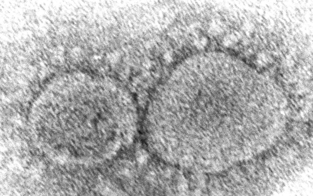 This 2020 electron microscope image made available by the Centers for Disease Control and Prevention shows SARS-CoV-2 virus particles which cause COVID-19.  (Hannah A. Bullock, Azaibi Tamin/CDC via AP, File)