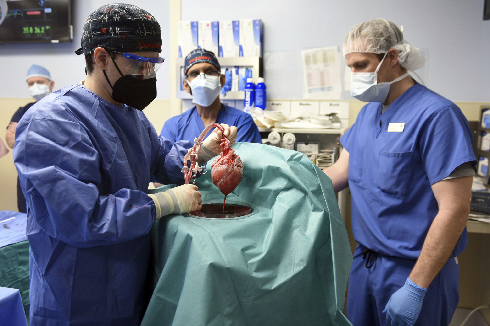 In world first, US surgeons successfully transplant a pig heart into human  patient | The Times of Israel