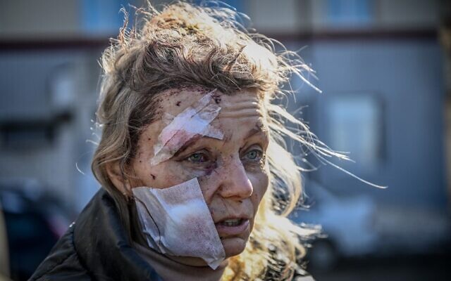 Olena Kurilo stands outside a hospital after the bombing of the eastern Ukraine town of Chuguiv, on February 24, 2022, as Russian armed forces attempt to invade Ukraine from several directions, using rocket systems and helicopters to attack Ukrainian position in the south, the border guard service said. (Aris Messinis/AFP)