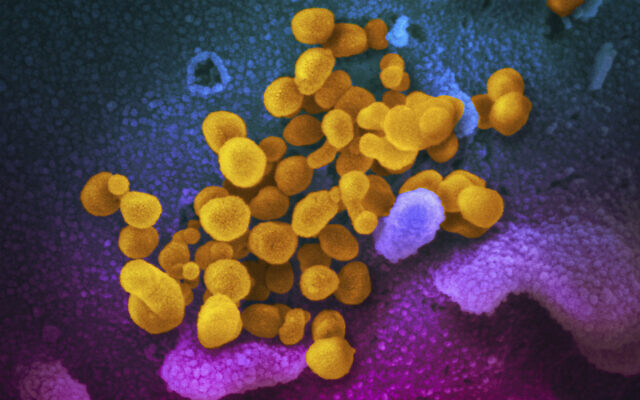 This undated, colorized electron microscope image made available by the US National Institutes of Health in February 2020 shows the Novel Coronavirus SARS-CoV-2, indicated in yellow, emerging from the surface of cells, indicated in blue/pink, cultured in the lab. (NIAID-RML via AP, File)
