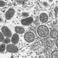 This 2003 electron microscope image made available by the Centers for Disease Control and Prevention shows mature, oval-shaped monkeypox virions, left, and spherical immature virions, right, obtained from a sample of human skin associated with the 2003 prairie dog outbreak. A leading doctor who chairs a World Health Organization expert group described the unprecedented outbreak of the rare disease monkeypox in developed countries as 'a random event' that might be explained by risky sexual behavior at two recent mass events in Europe. (Cynthia S. Goldsmith, Russell Regner/CDC via AP, File)