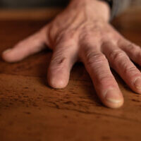 Illustrative: An amputated hand on a wooden table (BW Studio; iStock by Getty Images)