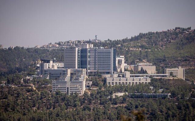 View of the Hadassah Ein Kerem Hospital in Jerusalem on August 17, 2021. (Yonatan Sindel/Flash90)