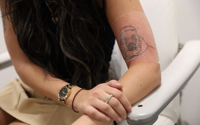 Client Kimberly sits at NAAMA Studios, a tattoo removal clinic in  Marylebone, London, on December 14, 2022, shows her tattoo picturing US singer Kanye West (Isabel INFANTES / AFP)