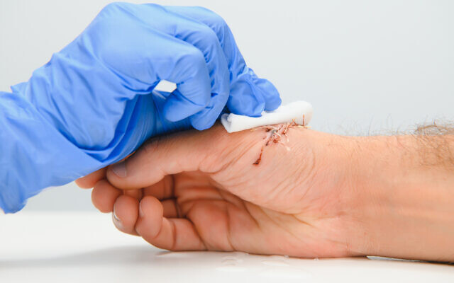 Illustrative: A nurse cleaning a wound on a patient (Serhii Hryshchyshen via iStock by Getty Images)