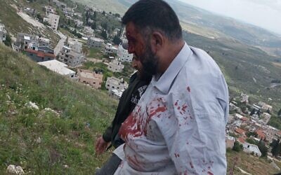 A Palestinian man after being allegedly beaten by Israeli settlers on April 30, 2023. (via WAFA)