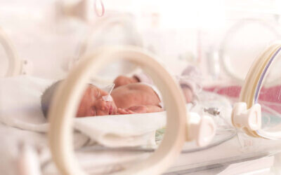A preterm neonate with a nasogastric tube in an incubator. (Courtesy of Elgan Pharma)