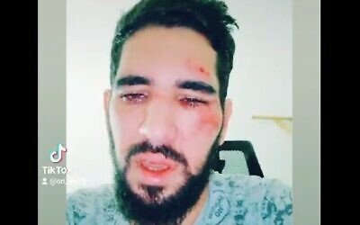 Ori Lev, 31, who was attacked outside a bar in the central city of Rehovot, August 18, 2023. (TikTok video screenshot: used in accordance with Clause 27a of the Copyright Law)