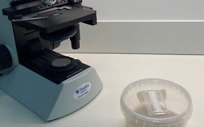 Israeli startup MadeRight develops fungi-based alternative fossil-derived plastic packaging. (Courtesy)