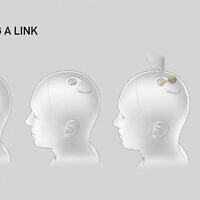 File: This video grab made from the online Neuralink livestream shows a drawing of the different steps of the implantation of a Neuralink brain implant device seen during a presentation on August 28, 2020. (Neuralink/AFP)