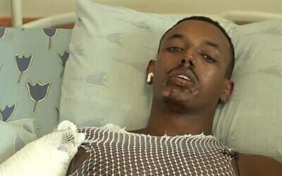 Fekadu Abera speaks with Channel 12 from his hospital bed in Tel Aviv on September 3, 2023. (Channel 12 screenshot; used in accordance with Clause 27a of the Copyright Law)